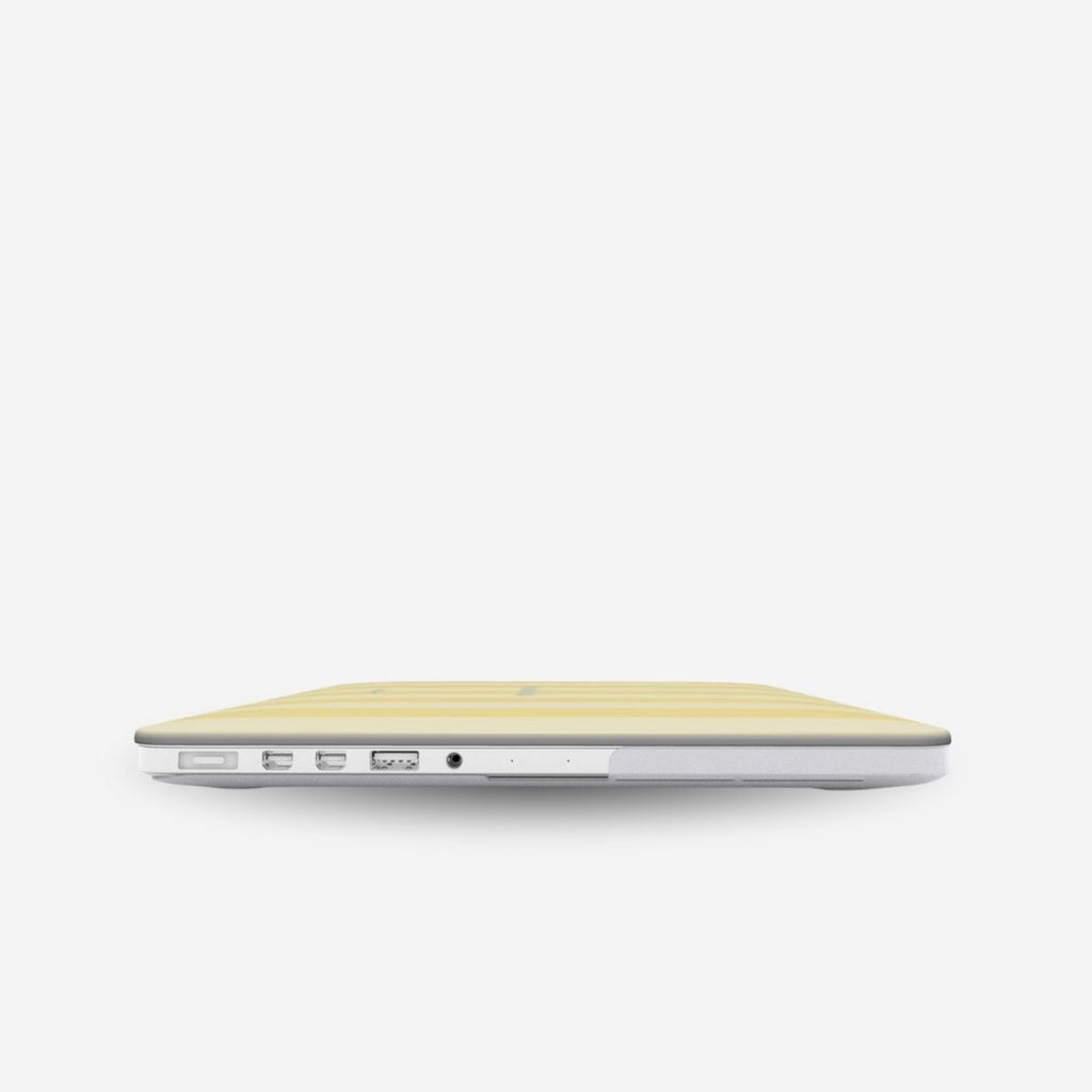 Dolce Vita coque MacBook